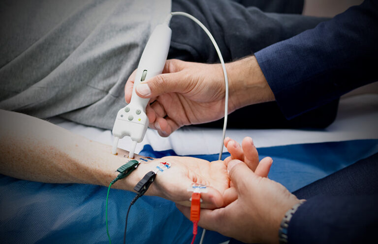 Nerve Conduction Study (NCS) | QNeurology